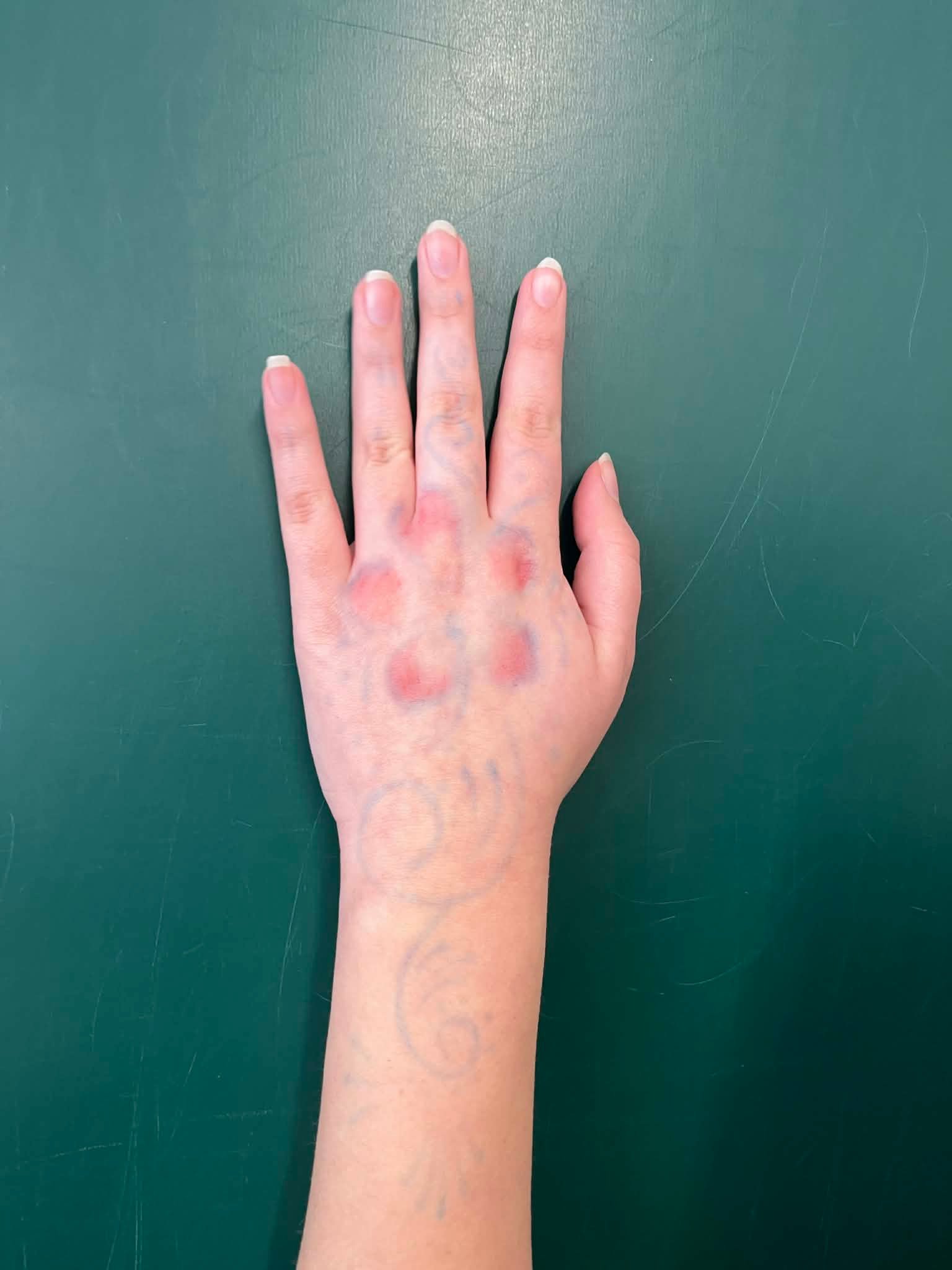 Palm with Drawings